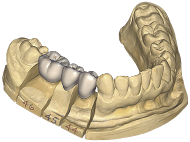 stage_start_dentalcad_desktop
