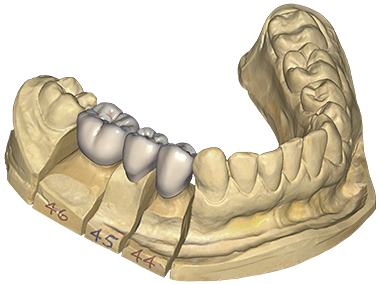 stage_start_dentalcad_desktop